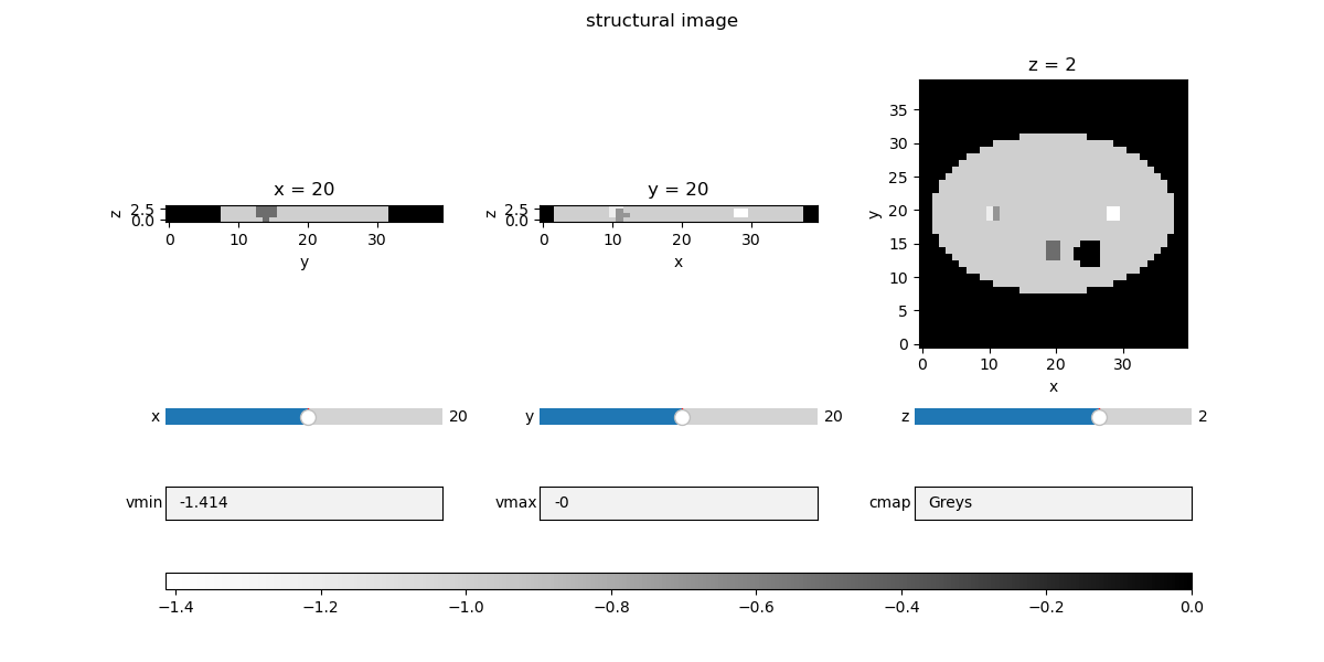 structural image, x = 20, y = 20, z = 2