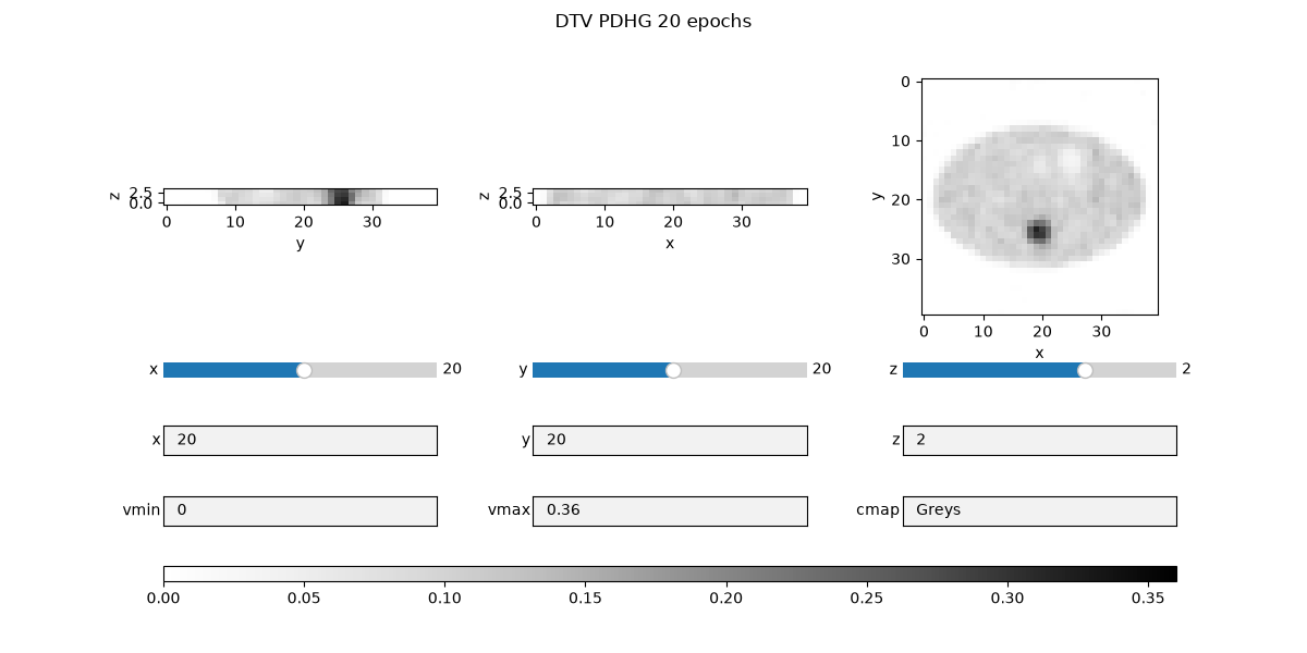 DTV PDHG 20 epochs